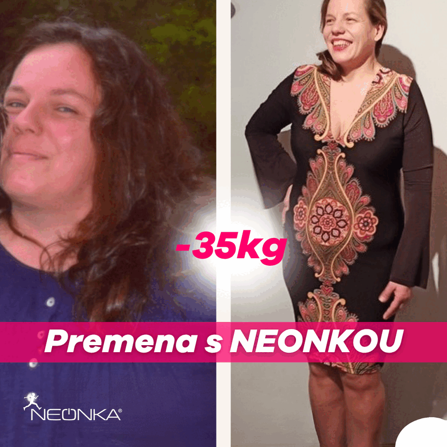 Zuzka schudla s nami 35 kíl